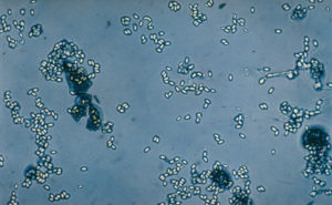 Nosema